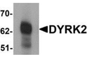 Western blot analysis of DYRK2 in 293 cell lysate with DYRK2 antibody at (A) 1 and (B) 2 μg/ml. (DYRK2 antibody  (C-Term))