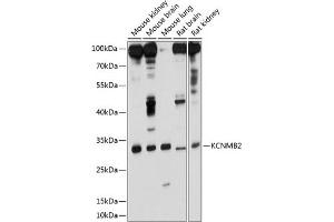 Western blot analysis of extracts of various cell lines, using KCNMB2 antibody (ABIN6129436, ABIN6142762, ABIN6142763 and ABIN6214468) at 1:1000 dilution. (KCNMB2 antibody  (AA 68-194))