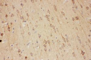 Anti-RTN3 antibody, IHC(P) IHC(P): Rat Brain Tissue (Reticulon 3 antibody  (C-Term))