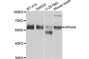Western blot analysis of extracts of various cell lines, using KPNA6 antibody (ABIN5975280) at 1/1000 dilution. (KPNA6 antibody)
