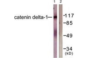 Western blot analysis of extracts from HuvEc cells, using Catenin-delta1 (Ab-228) Antibody.