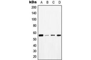 Western blot analysis of TAU (pT534) expression in HeLa (A), COLO205 (B), NIH3T3 (C), H9C2 (D) whole cell lysates.