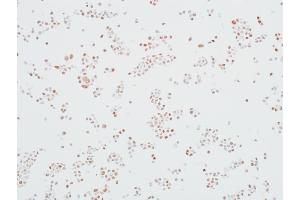 Immunocytochemistry (ICC) image for anti-Mediator Complex Subunit 12 (MED12) (AA 2127-2177) antibody (ABIN7453977) (Recombinant MED12 antibody  (AA 2127-2177))