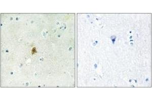 Immunohistochemistry analysis of paraffin-embedded human brain tissue, using TAF15 Antibody. (TAF15 antibody  (AA 351-400))
