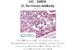Image no. 1 for anti-Signal-Regulatory Protein alpha (SIRPA) antibody (ABIN1739274) (SIRPA antibody)