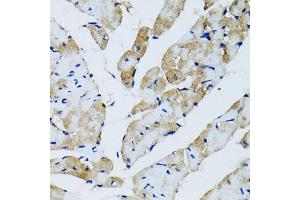 Immunohistochemistry of paraffin-embedded rat heart using GABARAP antibody. (GABARAP antibody  (AA 1-100))