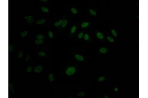 Immunofluorescence staining of Hela Cells with ABIN7127654 at 1:50, counter-stained with DAPI. (Recombinant MAPK14 antibody)