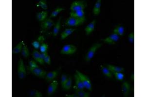 Immunofluorescence staining of Hela cells with ABIN7167082 at 1:166, counter-stained with DAPI. (REPS1 antibody  (AA 105-230))