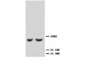 Image no. 1 for anti-Metalloproteinase Inhibitor 2 (TIMP2) (C-Term) antibody (ABIN1493035) (TIMP2 antibody  (C-Term))