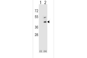 Western blot analysis of DCN using rabbit polyclonal DCN Antibody using 293 cell lysates (2 ug/lane) either nontransfected (Lane 1) or transiently transfected (Lane 2) with the DCN gene.