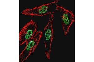 Western blot analysis in Hela cell line and human placenta tissue lysates (35ug/lane) using MyoD1 Antibody . (MYOD1 antibody  (Middle Region))