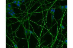 Immunofluorescent staining of differentiated SH-SY5Y cells (right). (SNRPN antibody  (AA 14-174))