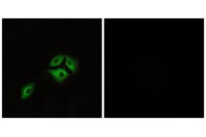 Immunofluorescence analysis of A549 cells, using NMBR antibody. (NMBR antibody  (Internal Region))