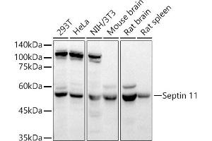 Western blot analysis of extracts of various cell lines, using Septin 11 antibody (ABIN6129126, ABIN6147548, ABIN6147550 and ABIN6215781) at 1:4890 dilution. (Septin 11 antibody  (AA 1-120))