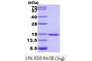 Figure annotation denotes ug of protein loaded and % gel used. (SUMO1 Protein (AA 1-97))