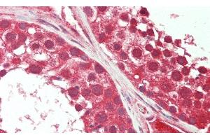 Detection of DHEA in Human Testis Tissue using Monoclonal Antibody to Dehydroepiandrosterone (DHEA)