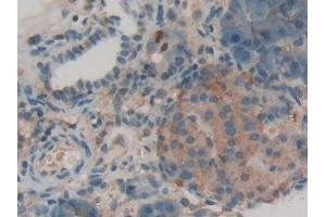 Detection of LPO in Rat Pancreas Tissue using Polyclonal Antibody to Lactoperoxidase (LPO)