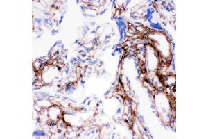 Anti-Collagen I antibody, IHC(F): Human Placenta Tissue (COL1A1 antibody  (C-Term))