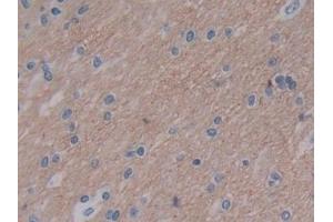 Detection of VSNL1 in Human Cerebrum Tissue using Polyclonal Antibody to Visinin Like Protein 1 (VSNL1) (VSNL1 antibody  (AA 39-184))