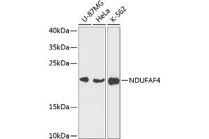 Western blot analysis of extracts of various cell lines, using NDUF antibody (ABIN7268807) at 1:3000 dilution.