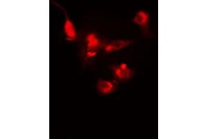 ABIN6272361 staining Hela by IF/ICC. (NFRKB antibody)
