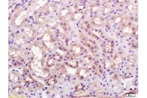 Formalin-fixed and paraffin embedded rat kidney labeled with Rabbit Anti K Cadherin Polyclonal Antibody, Unconjugated (ABIN715286) at 1:200 followed by conjugation to the secondary antibody and DAB staining (CDH6 antibody  (AA 281-380))