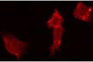 ABIN6272409 staining MCF7 by IF/ICC. (AGFG2 antibody  (Internal Region))
