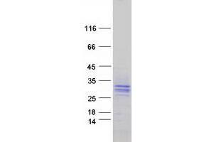 Signaling threshold Regulating Transmembrane Adaptor 1 (SIT1) protein (Myc-DYKDDDDK Tag)