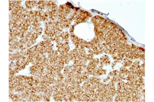 Formalin-fixed, paraffin-embedded human Parathyroid stained with PTH Mouse Recombinant Monoclonal Antibody (rPTH/911). (Recombinant PTH antibody  (AA 1-34))