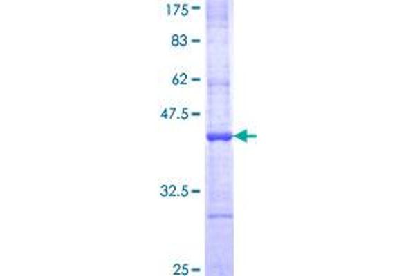 APOBEC1 Protein (AA 137-236) (GST tag)
