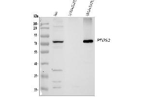 Western blot analysis of PTGS2 using anti-PTGS2 antibody (ABIN7600352).