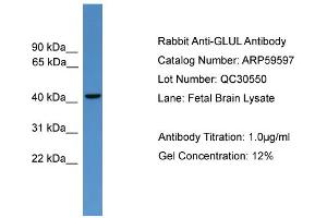 WB Suggested Anti-GLUL  Antibody Titration: 0.