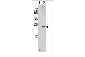 Western blot analysis of RAC1 (arrow) using rabbit polyclonal RAC1 Antibody. (RAC1 antibody  (Ser71))