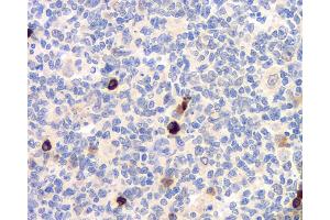 Immunohistochemistry analysis of paraffin-embedded human tonsil using CD284 Polyclonal Antibody at dilution of 1:500. (TLR4 antibody)