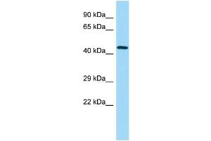 WB Suggested Anti-UBE2Q2 Antibody Titration: 1. (UBE2Q2 antibody  (Middle Region))