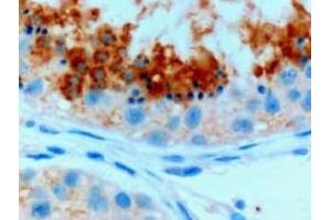 Image no. 1 for anti-Glutathione Peroxidase 4 (GPX4) (C-Term), (Isoform A) antibody (ABIN374711) (GPX4 antibody  (C-Term, Isoform A))