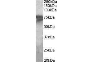 ABIN2564412 (2µg/ml) staining of Human Liver lysate (35µg protein in RIPA buffer). (PEPCK antibody  (Internal Region))