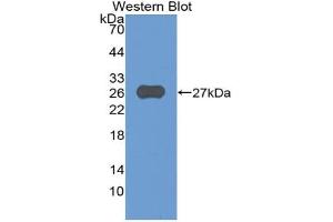 Western blot analysis of the recombinant protein. (ADAM8 antibody  (AA 371-587))
