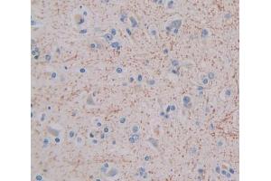 Used in DAB staining on fromalin fixed paraffin- embedded brain tissue (GHRHR antibody  (AA 23-130))