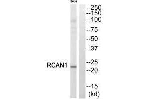 Western blot analysis of extracts from HeLa cells, using RCAN1 antibody. (RCAN1 antibody  (C-Term))
