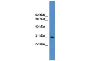 WB Suggested Anti-GTF2E2 Antibody Titration:  0. (GTF2E2 antibody  (N-Term))