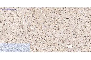 Immunohistochemistry of paraffin-embedded Human uterus tissue using PPIB Monoclonal Antibody at dilution of 1:200. (PPIB antibody)