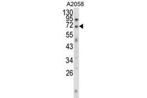 Western blot analysis of EWSR1 Antibody (C-term) in A2058 cell line lysates (35ug/lane).