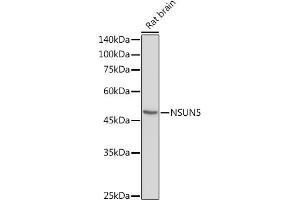 Western blot analysis of extracts of Rat brain, using NSUN5 antibody (ABIN7268955) at 1:1000 dilution.