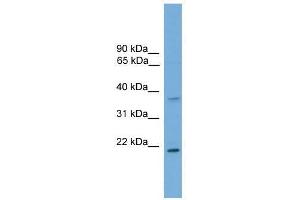 GSTM1 antibody used at 0. (GSTM1 antibody  (C-Term))
