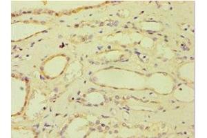Immunohistochemistry of paraffin-embedded human kidney tissue using ABIN7144870 at dilution of 1:100 (ATP5J antibody  (AA 1-108))