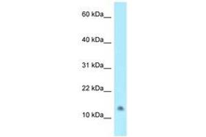 Image no. 1 for anti-N-Acetyltransferase 8-Like (GCN5-Related, Putative) (NAT8L) (C-Term) antibody (ABIN6747980) (NAT8L antibody  (C-Term))