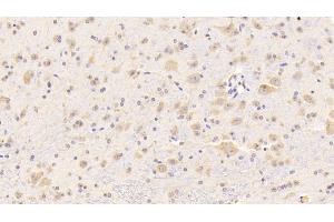 Immunohistochemistry (IHC) image for anti-Cathepsin D (CTSD) (AA 66-410) antibody (ABIN7433375)