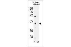 Western blot analysis of SAMD8 Antibody (N-term) Cat.
