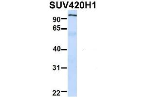 Host:  Rabbit  Target Name:  NSUN6  Sample Type:  Human Fetal Lung  Antibody Dilution:  1. (SUV420H1 antibody  (Middle Region))